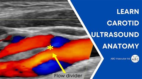 Carotid artery Doppler ultrasound test. Accurate examination to perform a basic ultrasound ...