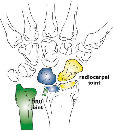 Mvmt Sci 07 Wrist And Hand Complex Flashcards Quizlet