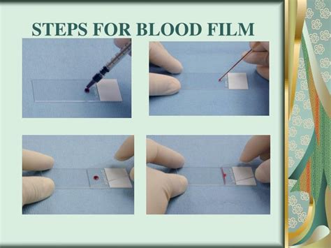 PPT Blood Smear Preparation And Staining PowerPoint Presentation ID