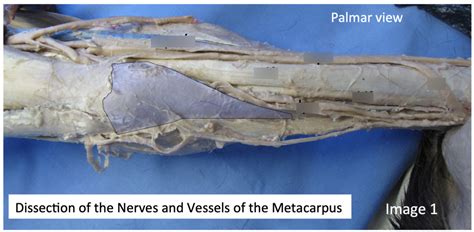 LA Anatomy: Equine Nerves & Vessels of Metacarpus (Palmer View) Diagram | Quizlet