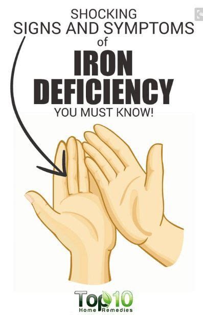 10 Signs And Symptoms Of Iron Deficiency With Images Health Facts Health Matters Health Info