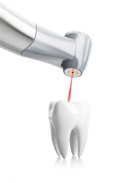 Detect And Treat Cavities With Laser Dentistry Hardy Pediatric