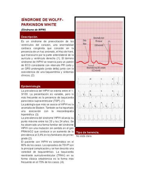 Sx Wolff Parkinson White SÍndrome De Wolff Parkinson White