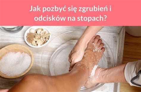 Jak Pozby Si Zgrubie I Odcisk W Na Stopach Food Peanut Butter