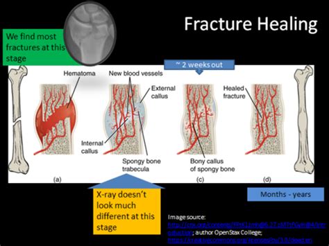 Week 5 1 Intro To Trauma Flashcards Quizlet