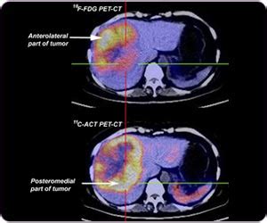 Department of Nuclear Medicine Positron Emission Tomography 同位素及正電子掃描部