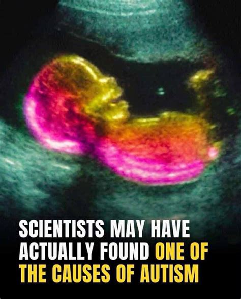 Scientists May Have Actually Found One Of The Causes Of Autism