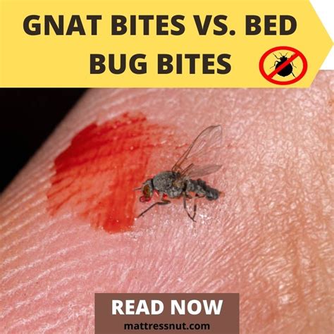 Bed Bug Bites Vs Gnat Bites Nbkomputer