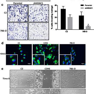 Hdac And Hdac Increase Mmp Activity And Decrease Acetylated