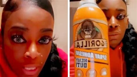 Bunnings Gorilla Glue Girl Finally Gets Hair Unstuck With Surgery Au — Australia’s