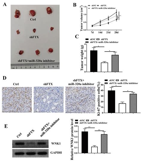 Mir 320a Inhibitor Attenuated The Inhibitory Effect Of Knockdown Of Ftx