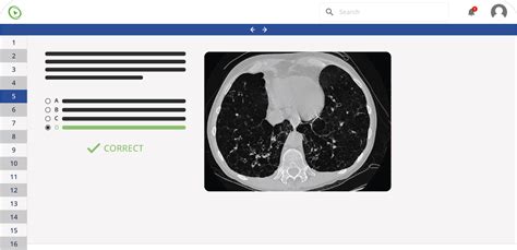 USMLE Step 2 CK Qbank Incl FREE Practice Questions Lecturio Online