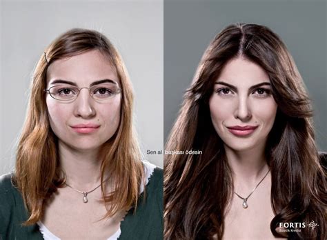 10 Plastic Surgery Ads From Around The World Zwivel Newsroom