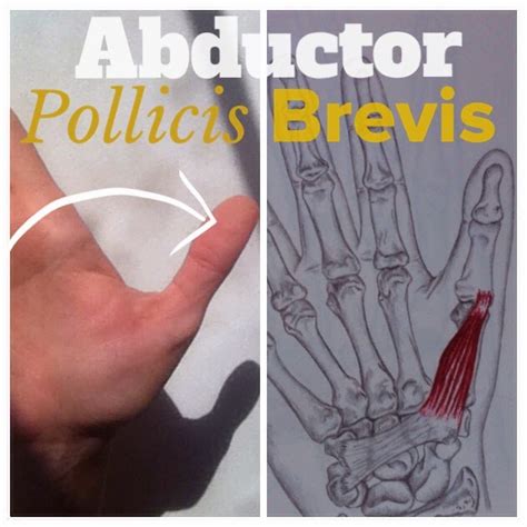 The Hip Joint: The final two 'short thumb muscles' 3) Abductor Pollicis Brevis & 4) Flexor ...