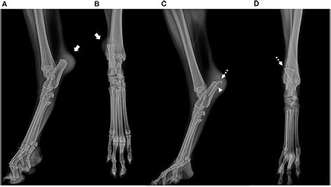 Frontiers Case Report Block Recession Calcaneoplasty Of The