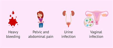 Symptoms Of Recurrent Miscarriages