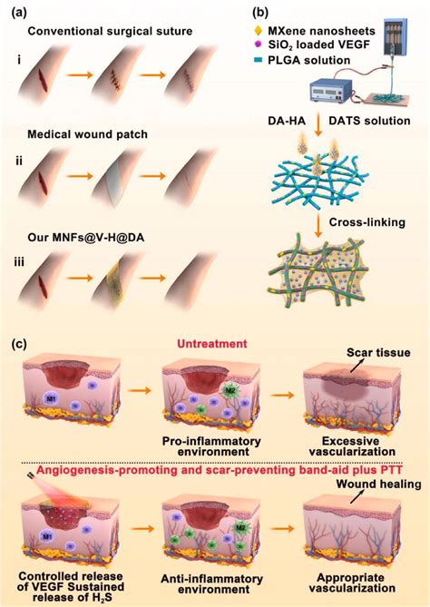 Aiding Wound Healing With Hybrid Hydrogel And Nanofibers