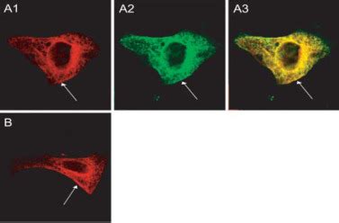 Kcne Is An Inhibitory Subunit To Kv And Kv Potassium Channels