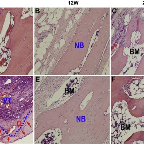 Masson Staining Of The Cranial Bone Defect Sections In The Control Download Scientific Diagram