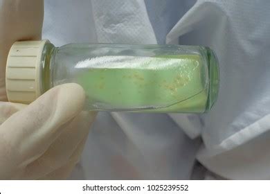 Mycobacterium Tuberculosis Culture Stock Photo 1025239552 | Shutterstock