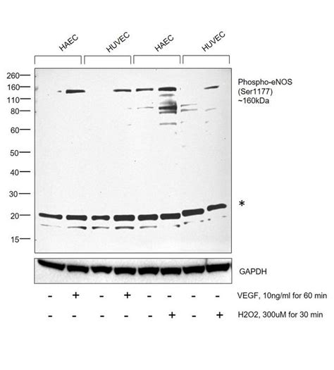 Phospho Enos Ser1177 Polyclonal Antibody Pa5 35879