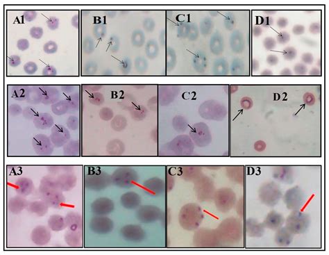 Medical Sciences Free Full Text Preliminary Investigation Into Plasmodium Like Piroplasms