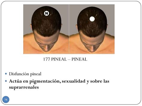 Pin En Par Biomagnetico Biomagnetic Magnetismo Imanes Magnetism Magnets