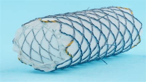 Airway Stent S And G Bio Product