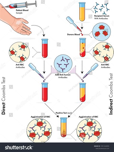 Illustration Coombs Test Immunology Blood Test Stock Vector Royalty