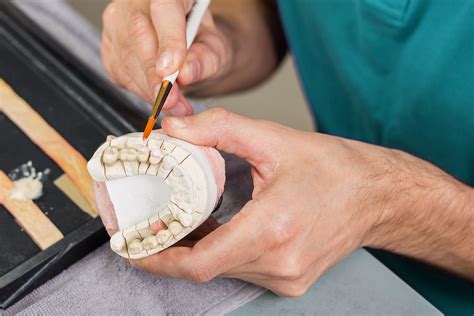 O Que Faz Um Técnico Em Prótese Dentária Dentlab