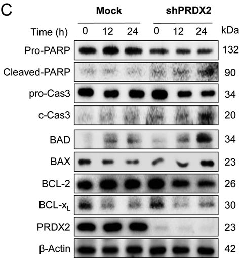 Peroxiredoxin Ii Inhibits Alcohol Induced Apoptosis In L02 Hepatocytes