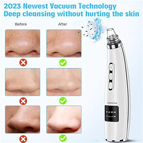 Buying Guide Newest Blackhead Remover Pore Vacuum Upgraded Facial