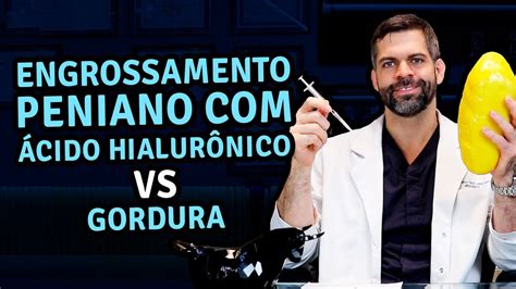 Engrossamento Peniano Cido Hialur Nico Vs Gordura Dr Marco T Lio