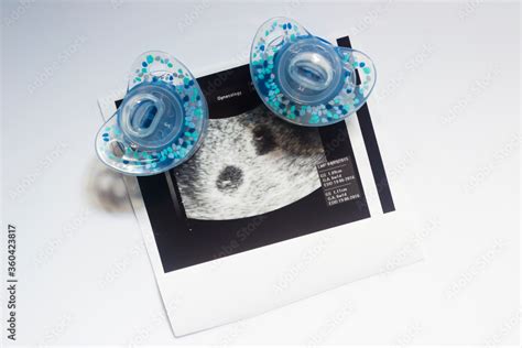 Twin pregnancy ultrasound. Two soothers and an ultrasound picture of ...