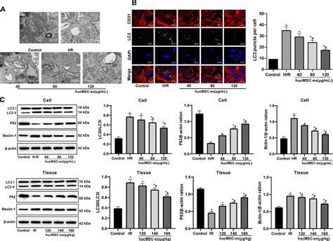 Transfer Of LncRNA UCA1 By HUCMSCs Derived Exosomes Protects Against