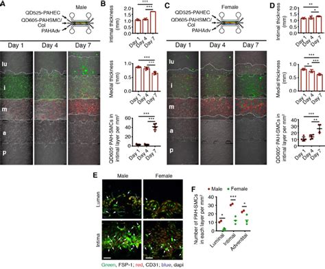 Figure S9 The Device Can Simulate The Pah Afflicted Pulmonary Arteries Download Scientific