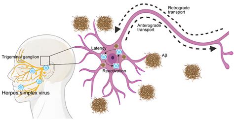 Schematic diagram of the potential mechanisms of herpes simplex virus ... 