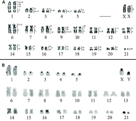 Karyotype Of R Mastacalis RMA 2n 44 FN 74 A G Banding With