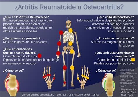 Medicina Interna Fase Artritis Reumatoide U Osteoartritis