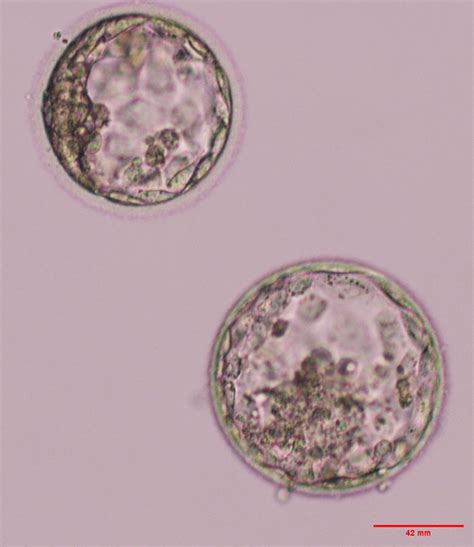 Oesophagostomum Egg