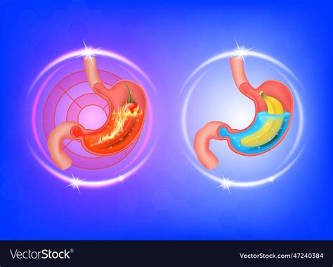 Healthy and sick stomach Royalty Free Vector Image