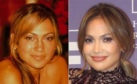 Jennifer Lopez before and after plastic surgery 10 – Celebrity plastic ...