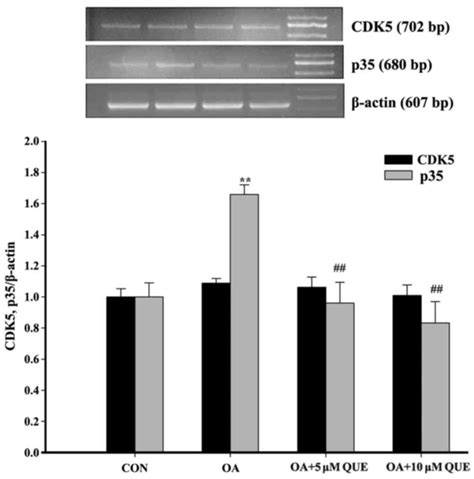 Quercetin Inhibits Okadaic Acid Induced Tau Protein