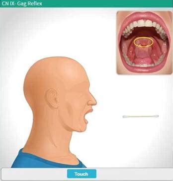 How To Check For Gag Reflex Signalsteel19