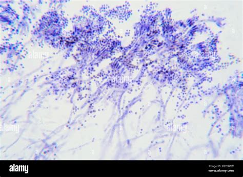 Ramas De Penicillium Hongos Ascomicetos Bajo El Microscopio Para Los