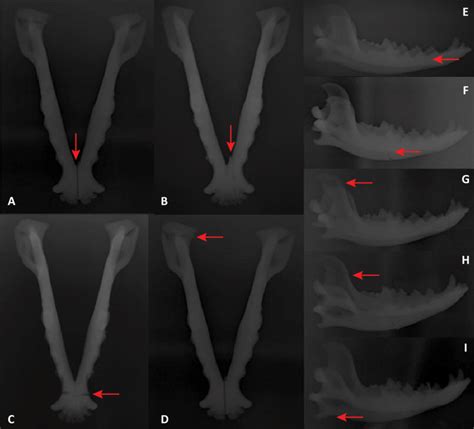 -Radiography of 3D CJF models. A. Mandibular symphysis; B. Mandibular ...