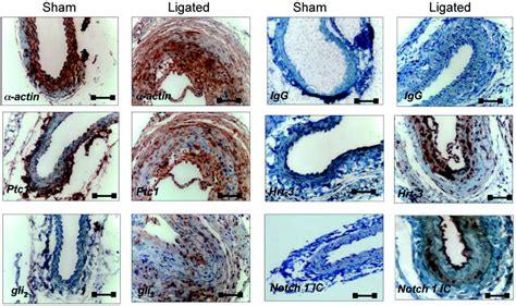 Sonic Hedgehog Induces Notch Target Gene Expression In Vascular Smooth