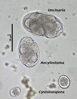 Ancylostoma egg