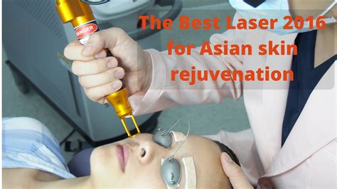 Best Laser For Asian Skin Rejuvenation Youtube