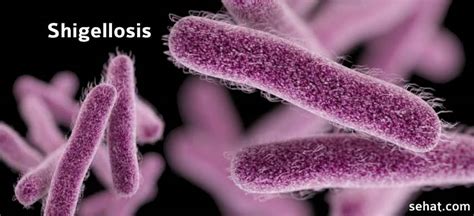 Shigellosis A Foodborne Illness Caused By Shigella Superbugs Bacteria